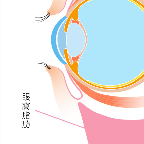 眼窩脂肪